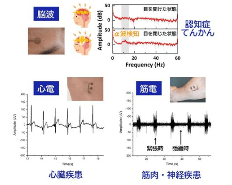 図2　電子皮膚による脳波・心電・筋電計測